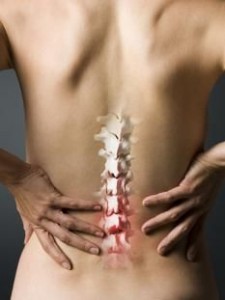 Spinal Arthritis