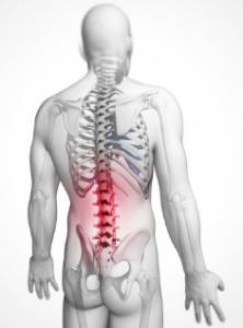 Spinal fusion surgery